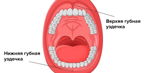 Расположение верхней и нижней уздечки