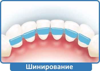 шинирование